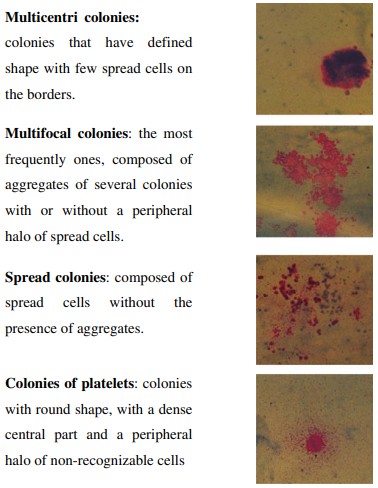 Morphology of in vitro Mk-CFU colonies. (Pessina, 2009)